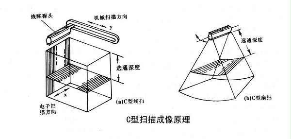 超声设备成像