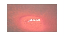 关于“超声波塑焊机”的筛分功能你知道吗？（二）