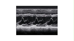 医药学中超声波查验的基本原理（二）